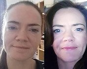 Juice Plus Reviews. My own before and after pictures